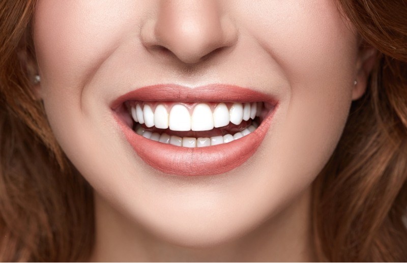 Close up of woman smiling and showing teeth