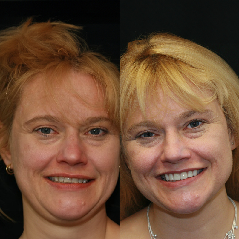 Red haired woman looking at smile in mirror