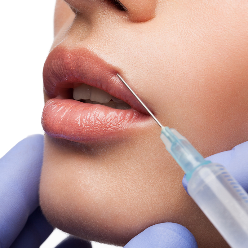 Woman receiving lip enhancement treatment