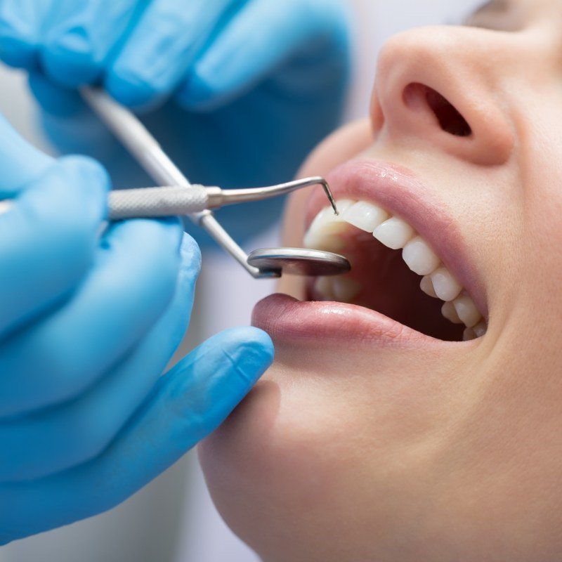 Close up of patients mouth being treated