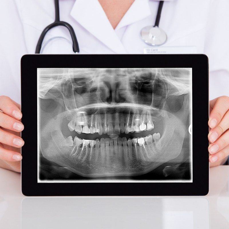 Dentist holding tablet showing a digital X ray