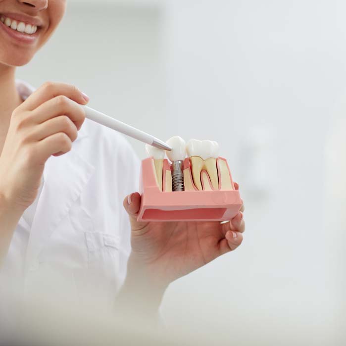 Dentist holding model of dental implant in Boston