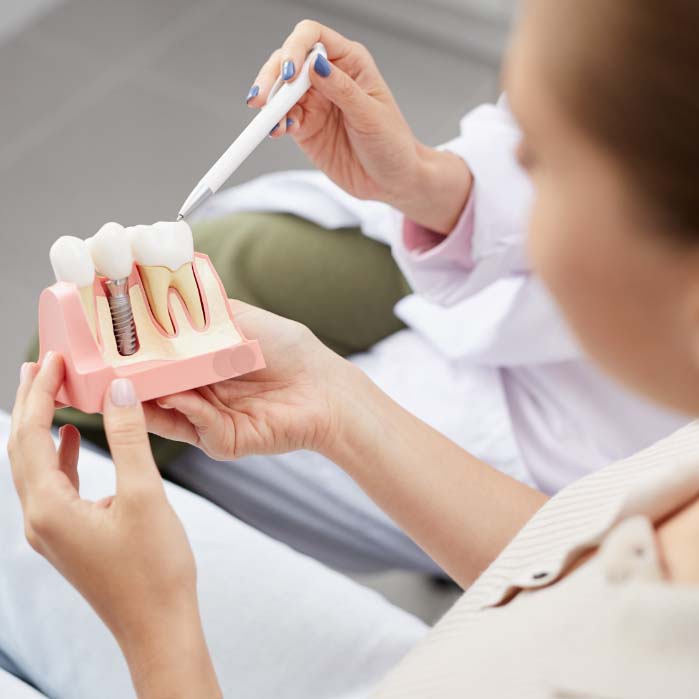 Patient holding model of dental implant