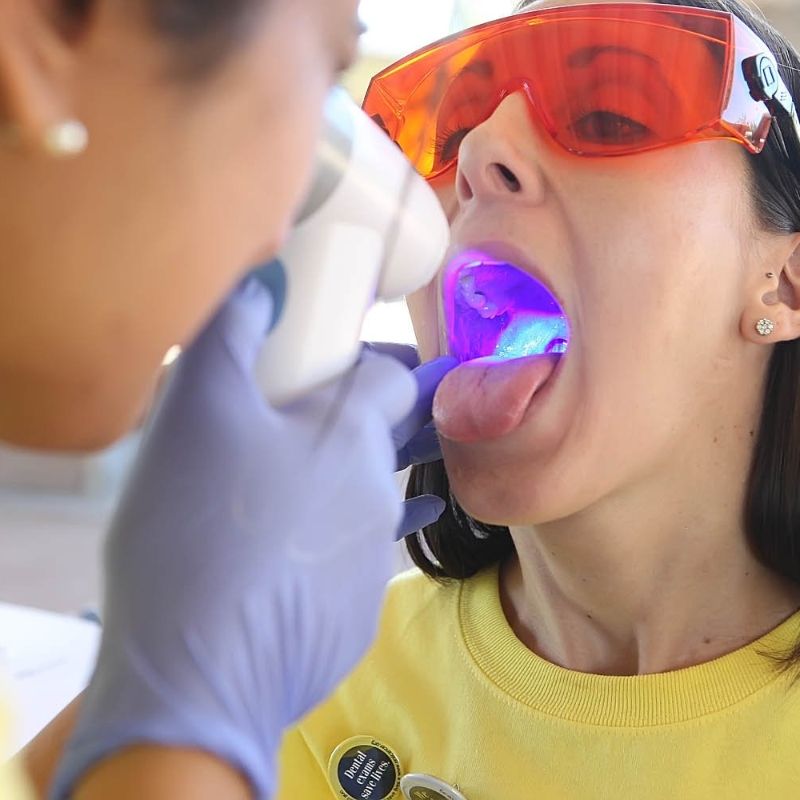 Woman holding mouth open for oral cancer screening