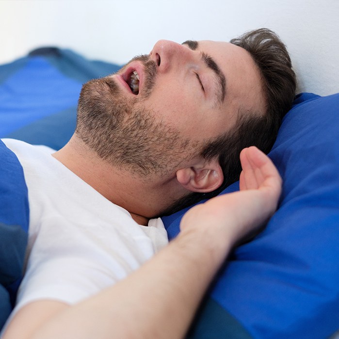 Bearded man lying in bed snoring due to sleep apnea in Boston