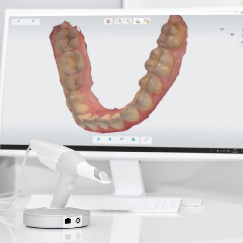 Scanner in front of digital image of teeth